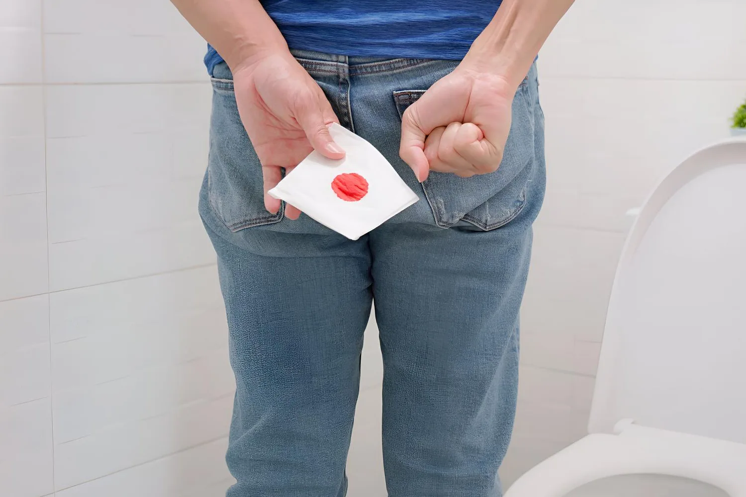 Atención de sangrado anal o sangrado intestinal en Ensenada, B.C.: Diagnóstico y tratamiento especializado